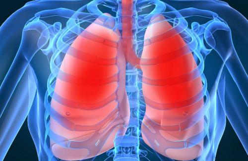 Biến chứng hen phế quản có thể gây tràn dịch màng phổi
