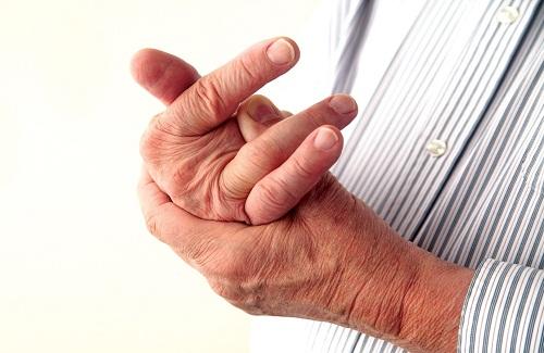 Những biến chứng của bệnh gout mà có thể bạn chưa biết