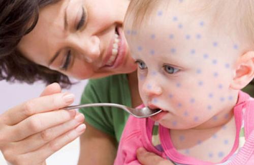 Chăm sóc trẻ bệnh tay chân miệng hiệu quả tại nhà các mẹ nên tham khảo