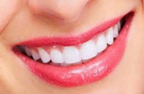 Men răng và những yếu tố ảnh hưởng đến men răng chúng ta cần quan tâm