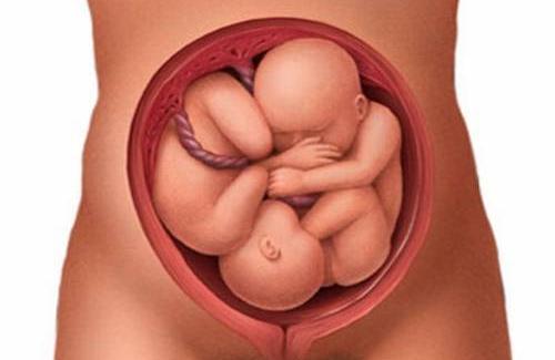 Ngôi thai ngược là gì? Các yếu tố khác ảnh hưởng đến ngôi thai ngược