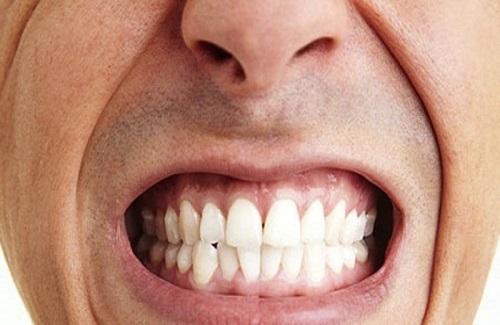 Mách cho bạn một số mẹo dân gian chữa nghiến răng khi ngủ đơn giản