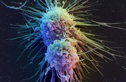 Tế bào tua là gì? Các loại tế bào có tua của mô lympho