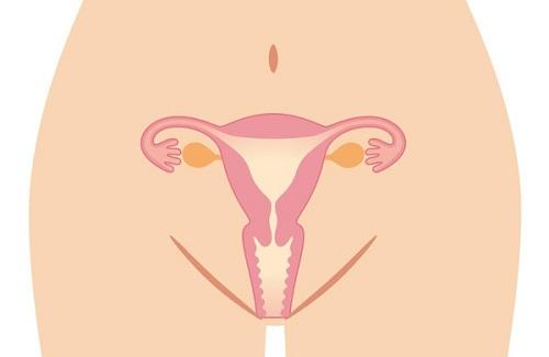 U nang buồng trứng xoắn - một biến chứng cực kỳ nguy hiểm với chị em