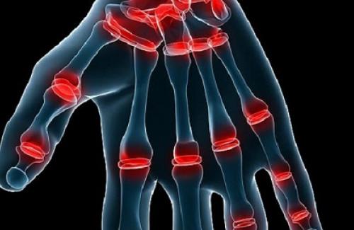 Khớp xương là gì? Phân loại khớp xương và cấu tạo của khớp động