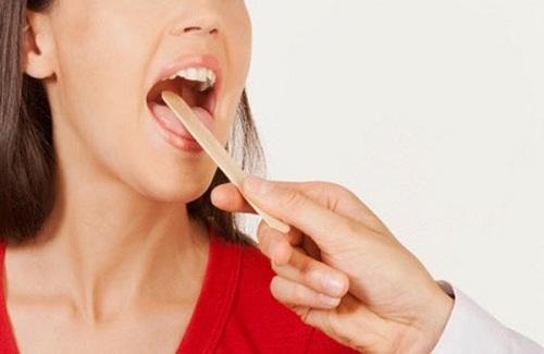 Những cách phòng ung thư vòm họng hiệu quả mà bạn không nên bỏ qua