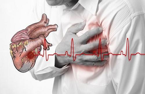 Tìm hiểu thế nào là ngừng tim? Nguyên nhân nào dẫn đến ngừng tim