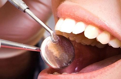 Mách bạn những kinh nghiệm nhổ răng khôn giúp giảm đau và biến chứng