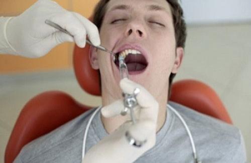 Tìm hiểu về răng khôn - Những biến chứng nguy hiểm do răng khôn gây ra