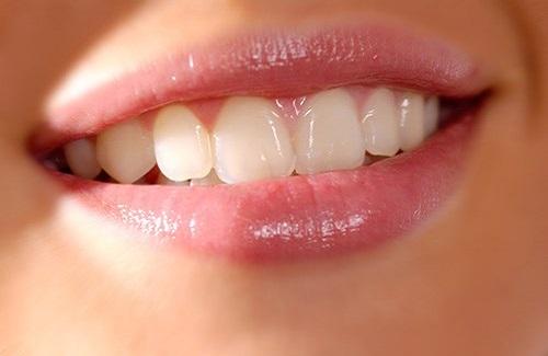 Tẩy trắng răng bằng giấm đơn giản mà hiệu quả bạn nên áp dụng