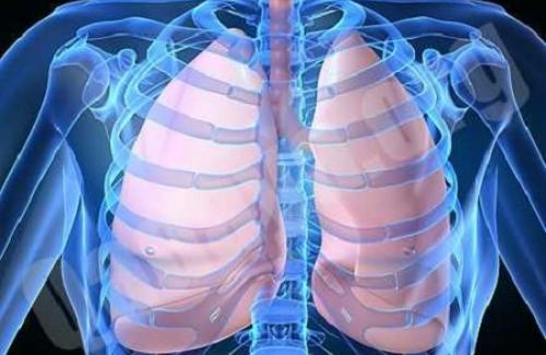 Tràn khí màng phổi là bệnh gì? Triệu chứng, nguyên nhân và điều trị bệnh