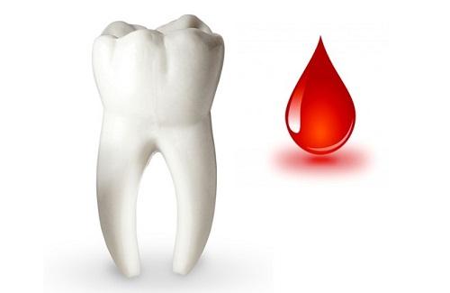 Cách trị chảy máu chân răng dứt điểm đơn giản tại nhà bạn không thể ngờ