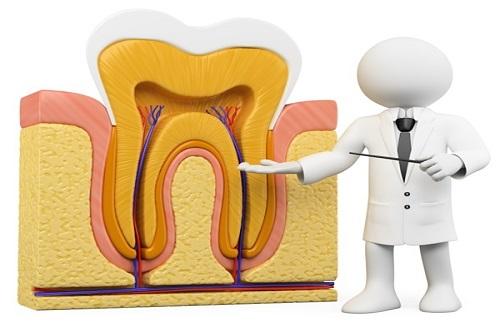 Triệu chứng viêm tủy răng - Một số triệu chứng dễ nhận biết nhất cho bạn