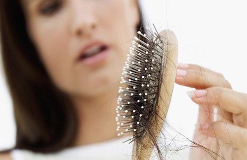 Cách chăm sóc tóc rụng hiệu quả với các nguyên tắc vàng dưới đây