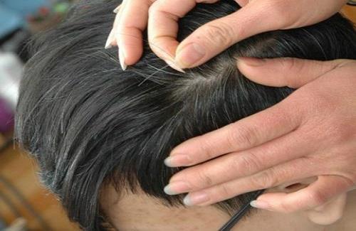 Chữa tóc bạc sớm bằng vừng đen hiệu quả bất ngờ cho bạn
