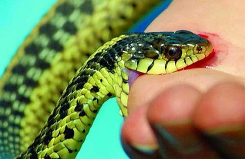 Khi bị rắn cắn cần có biện pháp xử trí sao cho đúng?