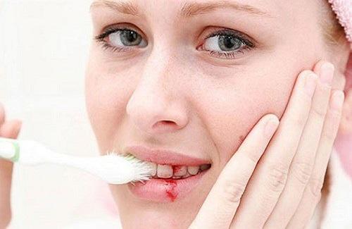 Tác hại không ngờ của việc chải răng không đúng cách