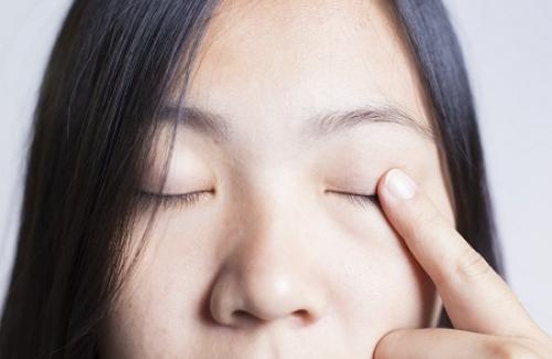 Chắp mắt là gì? Triệu chứng, nguyên nhân và cách điều trị chắp mắt