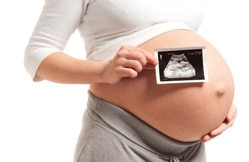 Tràng hoa quấn cổ ở thai nhi và một số câu hỏi thường gặp