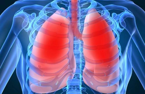 Xẹp phổi là bệnh gì? Triệu chứng, nguyên nhân và điều trị xẹp phổi