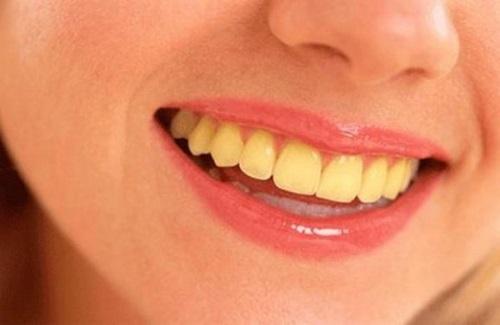 Cách làm trắng răng bị vàng nhanh chóng hiệu quả từ thực phẩm