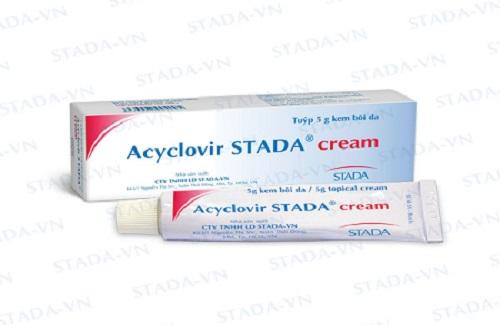 Acyclovir Stada cream - Thuốc điều trị nhiễm virus Herpes simplex ở da