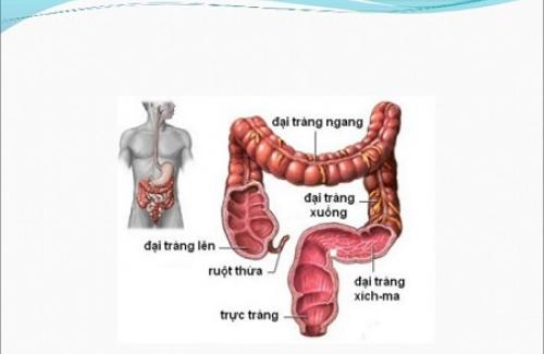 Bệnh Crohn là gì? Triệu chứng, nguyên nhân và điều trị bệnh
