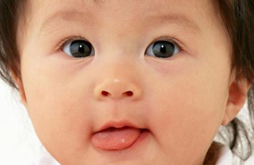 Bệnh tưa lưỡi ở trẻ sơ sinh - Triệu chứng, nguyên nhân và điều trị bệnh