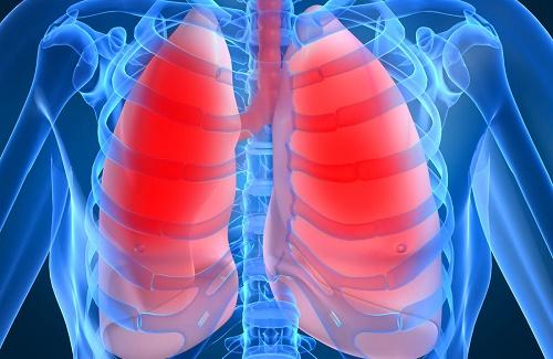 Phù phổi - Nguyên nhân, triệu chứng và cách phòng tránh