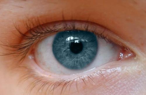 Bệnh glaucoma là gì? Triệu chứng, nguyên nhân và cách điều trị bệnh