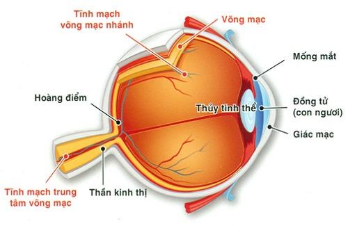 Tắc tĩnh mạch võng mạc - Bệnh lý có thể gây mất thị giác