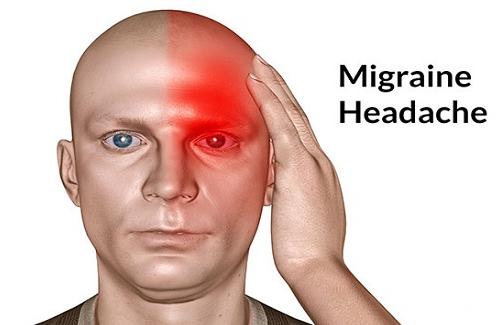 Bệnh đau nửa đầu - Nguyên nhân của căn bệnh đau nửa đầu