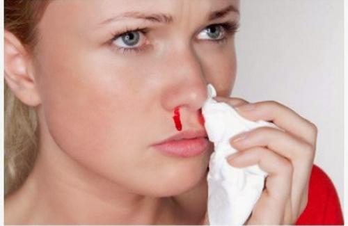 Chảy máu mũi là gì? Nguyên nhân và cách điều trị chảy máu mũi