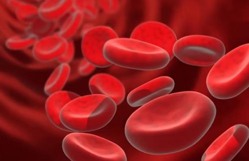 Thiếu máu hồng cầu nhỏ là gì? Triệu chứng, nguyên nhân và điều trị bệnh