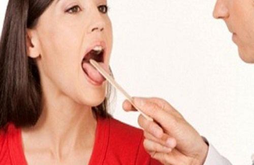 Viêm loét miệng lưỡi và những điều bạn không nên bỏ qua