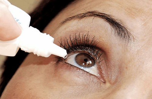 Bệnh viêm bờ mi ở mắt - Nguyên nhân, triệu chứng và cách điều trị