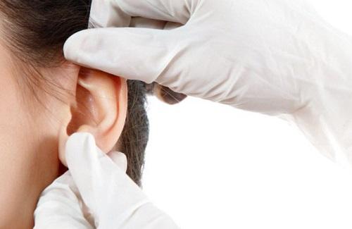 Cách điều trị viêm tai giữa mãn tính an toàn bạn nên áp dụng