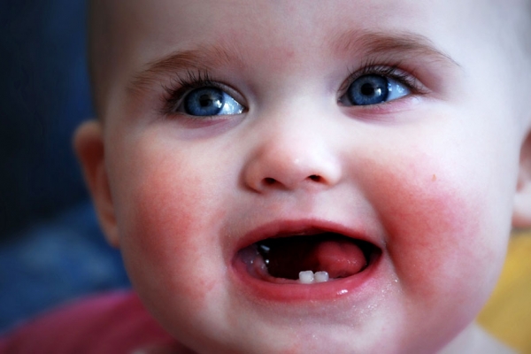 Những điều cần lưu ý khi trẻ mọc răng phụ huynh cần lưu ý