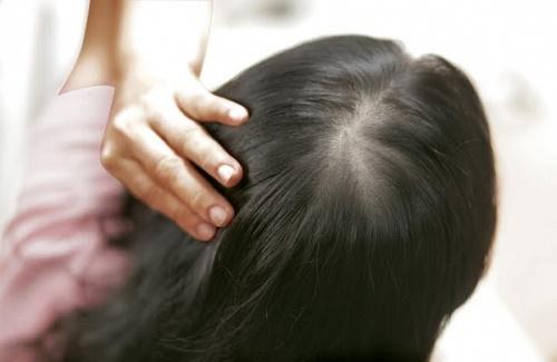 Biện pháp điều trị viêm chân tóc, tránh gây rụng tóc hiệu quả