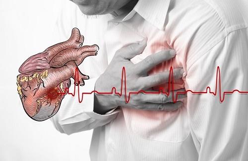 Đông y điều trị suy tim theo từng thể bệnh hiệu quả
