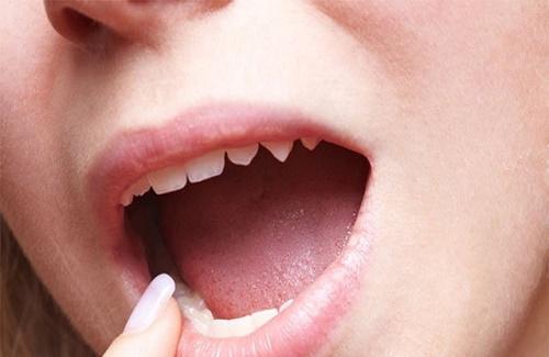Nhận diện một số bệnh thường gặp ở miệng ảnh hưởng tới sức khoẻ