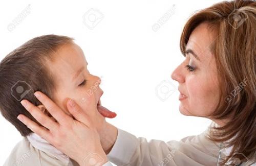 Viêm họng hạt là gì? Triệu chứng, nguyên nhân và điều trị bệnh