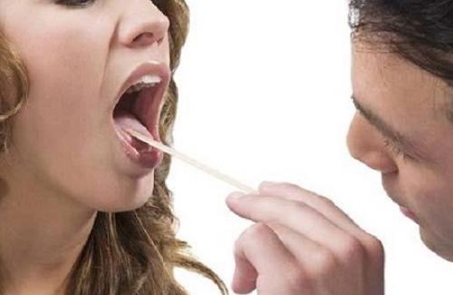 Viêm họng mạn là gì? Triệu chứng, nguyên nhân và điều trị bệnh