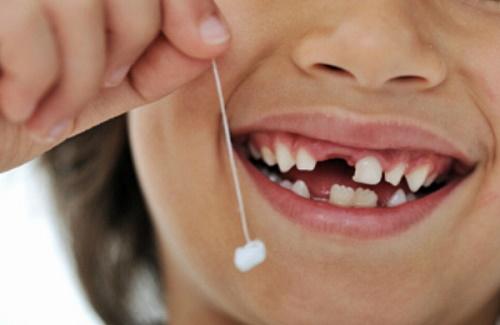 Hậu quả khi mất răng sữa sớm đến sức khỏe của trẻ nhỏ
