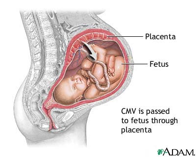 Phòng tránh nhiễm khuẩn thai nhi: Bảo vệ bé ngay từ trong bụng mẹ