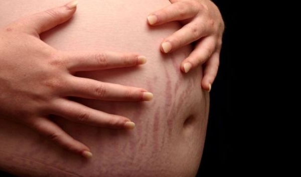 Phòng ngừa rạn da khi mang thai mẹ bầu không nên bỏ qua