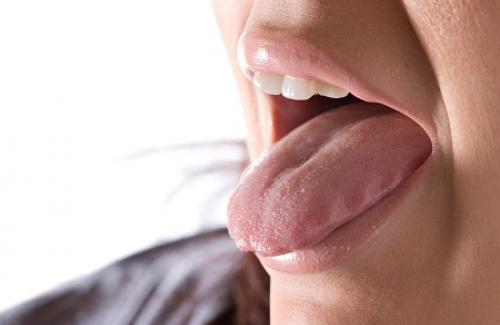 Rát lưỡi là sao? Triệu chứng, nguyên nhân và điều trị rát lưỡi