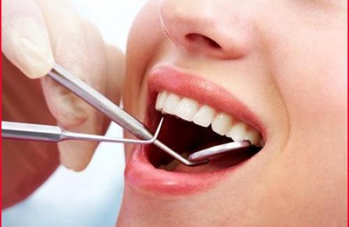 Viêm chóp chân răng là gì? Triệu chứng, nguyên nhân và điều trị bệnh