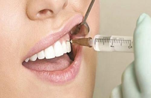Răng chết tủy là gì? Triệu chứng, nguyên nhân và điều trị bệnh