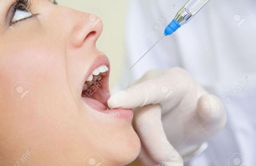 Viêm tủy răng là gì? Triệu chứng, nguyên nhân và điều trị bệnh